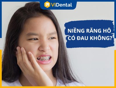 Niềng Răng Hô Có Đau Không? Giải Pháp Nào Không Gây Đau Đớn?