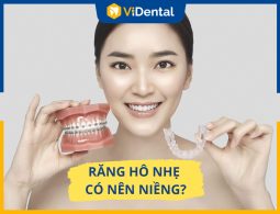 Răng Hô Nhẹ Có Nên Niềng Không? Giải Pháp, Địa Chỉ Nào Tốt?