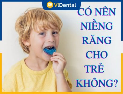 Có Nên Niềng Răng Cho Trẻ Em Không? [XEM NGAY]