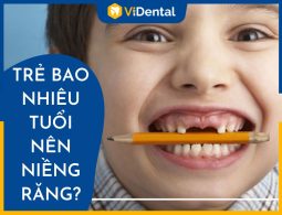 Độ Tuổi Niềng Răng Cho Trẻ Tốt Nhất Là Khi Nào - [XEM NGAY]