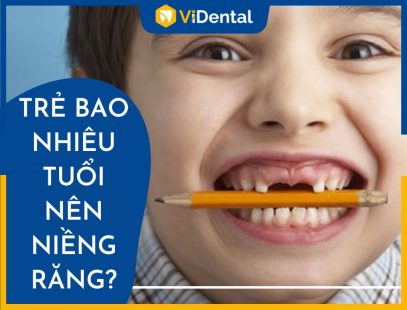 Độ Tuổi Niềng Răng Cho Trẻ Tốt Nhất Là Khi Nào - [XEM NGAY]