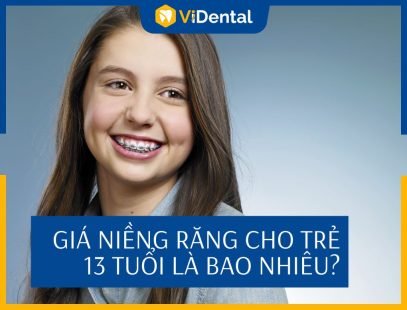 [Cập Nhật] Giá Niềng Răng Cho Trẻ 13 Tuổi Từng Phương Pháp