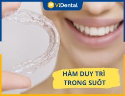 Bảng Giá Hàm Duy Trì Trong Suốt Và Địa Chỉ Mua Uy Tín