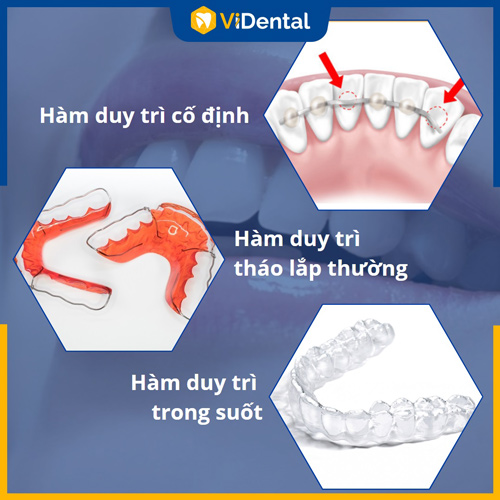 Hàm duy trì trong suốt được ưa chuộng nhờ tính thẩm mỹ cao, linh hoạt