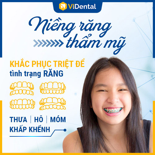 Niềng răng tại ViDental Brace - HIỆU QUẢ, AN TOÀN, GIÁ TỐT NHẤT