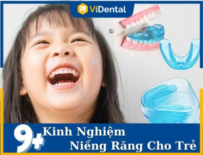 Bật Mí 9+ Kinh Nghiệm Niềng Răng Cho Trẻ Ba Mẹ Nên Biết