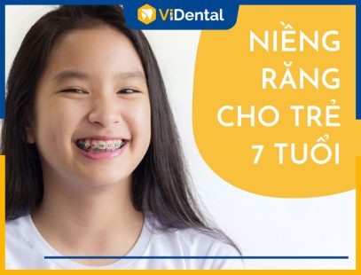 Niềng Răng Cho Trẻ 7 Tuổi: Hiệu Quả Và Quy Trình Thực Hiện