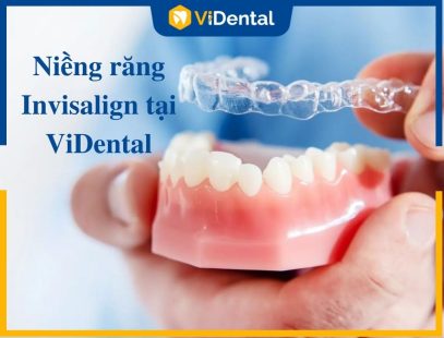 [Xem Ngay] Niềng Răng Invisalign Giá Bao Nhiêu Và Nên Thực Hiện Ở Đâu?