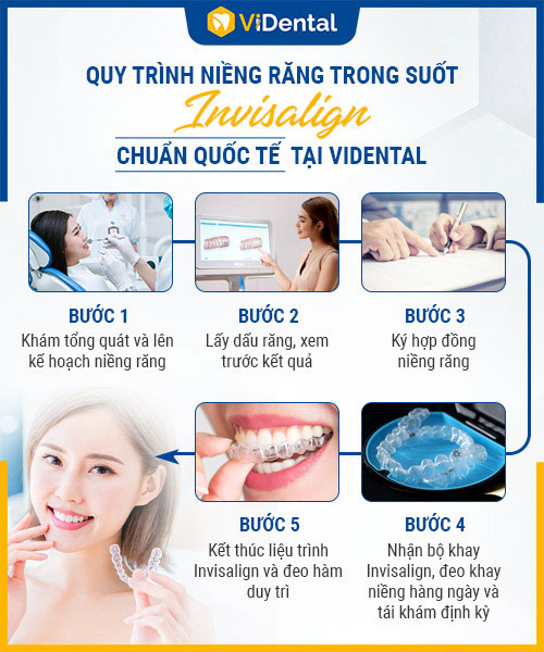 5 bước chỉnh nha không mắc cài hiệu quả tối ưu tại ViDental Brace