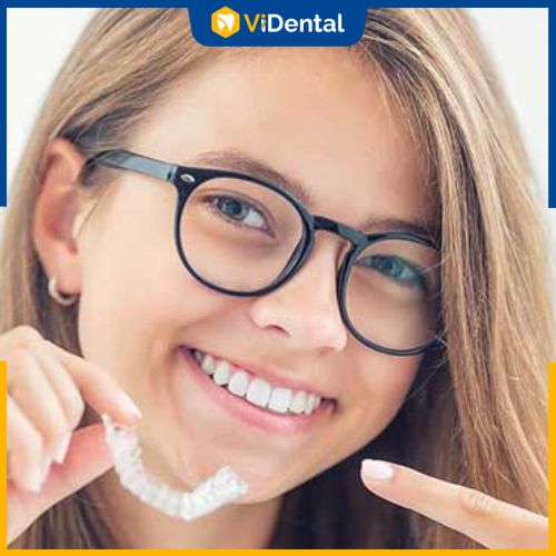 Khay niềng được sử dụng phổ biến nhất là invisalign