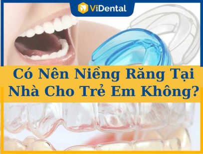 Có Nên Niềng Răng Tại Nhà Cho Trẻ Em Không? Phương Pháp