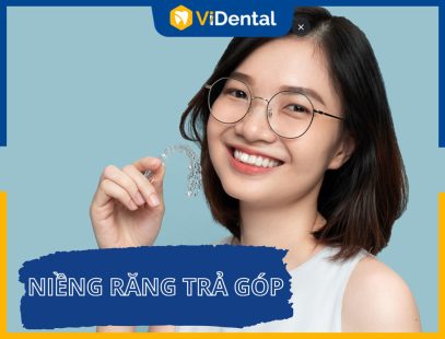 [Cập Nhật] Bảng Giá Và Thủ Tục Niềng Răng Trả Góp Lãi Suất 0%