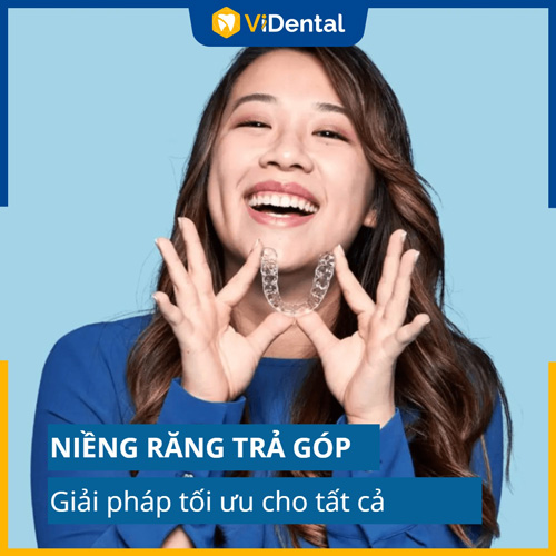 Niềng răng trả góp là giải pháp tối ưu chi phí chỉnh nha