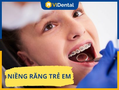 Bảng Giá Niềng Răng Trẻ Em Và Địa Chỉ Thực Hiện Uy Tín Nhất