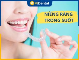 Niềng Răng Trong Suốt - Phương Pháp Chỉnh Nha Thẩm Mỹ Nhất