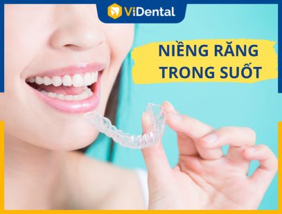 Niềng Răng Trong Suốt - Phương Pháp Chỉnh Nha Thẩm Mỹ Nhất