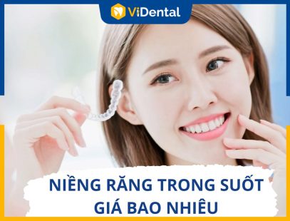 Niềng Răng Trong Suốt Giá Bao Nhiêu? Bảng Giá Mới Nhất