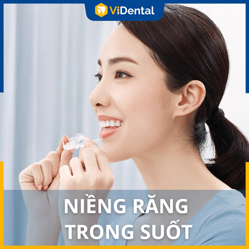 Nhiều người quan têm đến giá niềng răng trong suốt Hà Nội