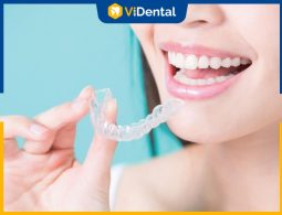 Niềng Răng Invisalign Giá Bao Nhiêu Tiền