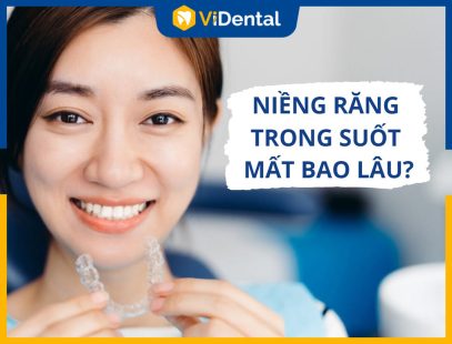 [Giải Đáp] Niềng Răng Trong Suốt Mất Bao Lâu Đạt Hiệu Quả?