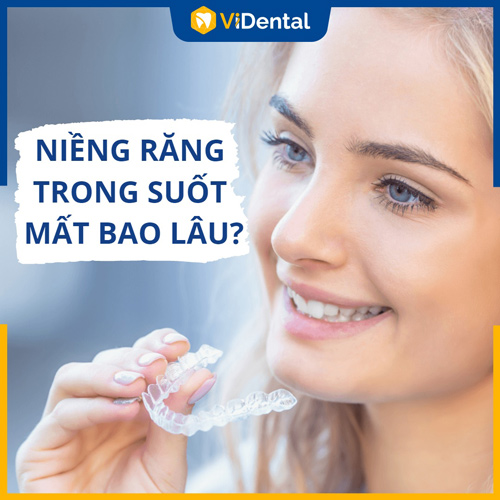 Thời gian niềng răng niềng răng trong suốt mất bao lâu?