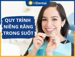 [CHI TIẾT] Quy Trình Niềng Răng Trong Suốt Invisalign Quốc Tế