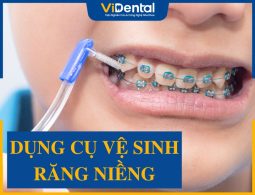 Gợi Ý 7 Dụng Cụ Vệ Sinh Răng Niềng Không Thể Thiếu