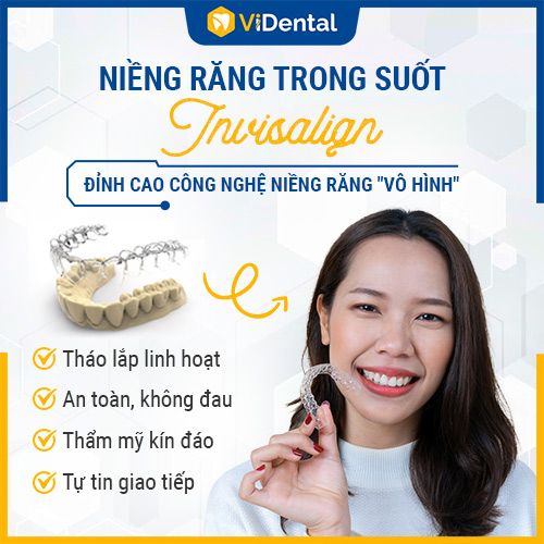 Giữa niềng răng 3D Clear và Invisalign, các bác sĩ đánh giá Invisalign cao hơn