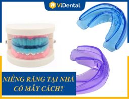 Niềng Răng Tại Nhà Có Mấy Phương Pháp? [TÌM HIỂU NGAY]