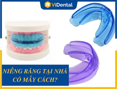 Niềng Răng Tại Nhà Có Mấy Phương Pháp? [TÌM HIỂU NGAY]