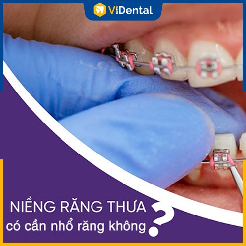 Giải đáp thắc mắc niềng răng thưa có cần nhổ răng hay không?