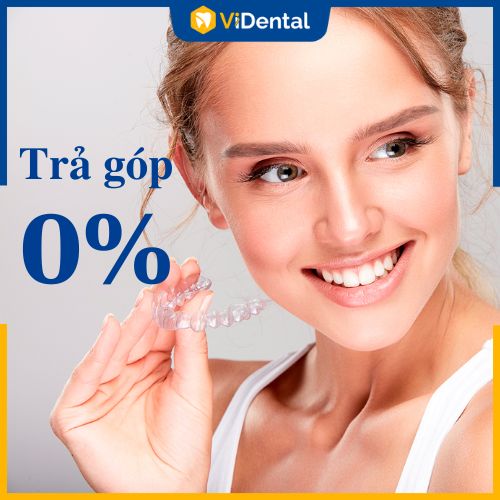 Niềng răng trả góp 0% tại ViDental Brace