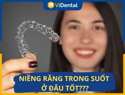 Niềng Răng Trong Suốt Ở Đâu Tốt? VIDENTAL- Lựa Chọn Tối Ưu