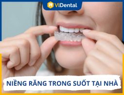 Niềng Răng Trong Suốt Tại Nhà: Hiệu Quả Và Cách Thực Hiện