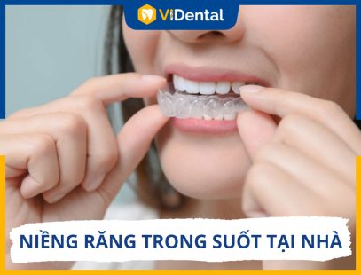 Niềng Răng Trong Suốt Tại Nhà: Hiệu Quả Và Cách Thực Hiện