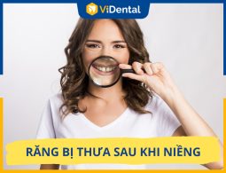 Vì Sao Răng Bị Thưa Sau Khi Niềng? Cách Xử Lý Hiệu Quả Nhất?