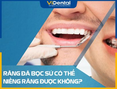 Răng Bọc Sứ Có Niềng Được Không Và Cần Lưu Ý Gì? Chuyên Gia Giải Đáp