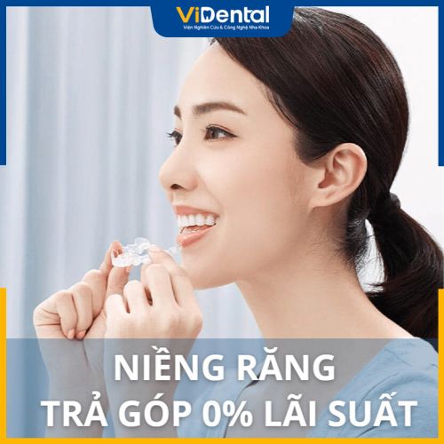 ViDental hỗ trợ trả góp lãi suất là 0%, không phát sinh chi phí