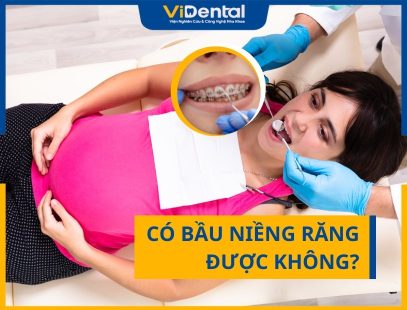 Có Bầu Niềng Răng Được Không?