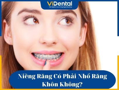 Niềng răng có cần nhổ răng khôn không là vấn đề mà nhiều khách hàng quan tâm