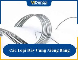 Các loại dây cung niềng răng là khí cụ hỗ trợ đắc lực cho phương pháp niềng răng bằng mắc cài