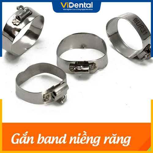 Band hay còn gọi là khâu chỉnh nha