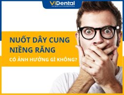 Nuốt Dây Cung Niềng Răng Ảnh Hưởng Có Ảnh Hưởng Gì Không?