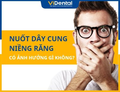 Nuốt Dây Cung Niềng Răng Ảnh Hưởng Có Ảnh Hưởng Gì Không?