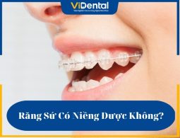 Giải Đáp: Răng Sứ Có Niềng Được Không? Phương Pháp Nào?