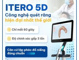 Công nghệ lấy dấu răng iTero 5D Vidental