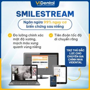 Công nghệ Smilestream kiểm soát biến chứng niềng