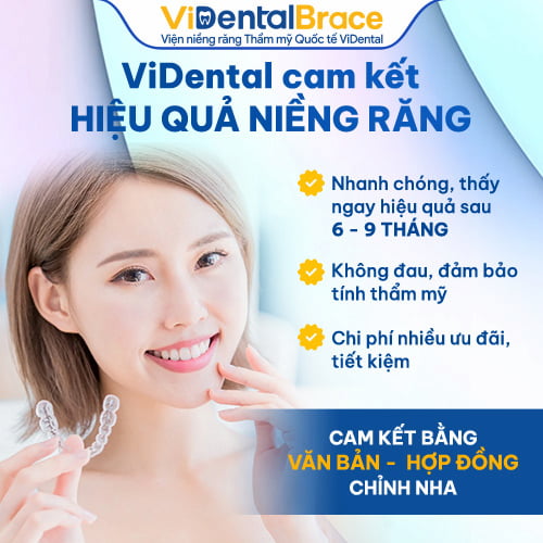 Hợp đồng chỉnh nha Trung Tâm ViDental Brace