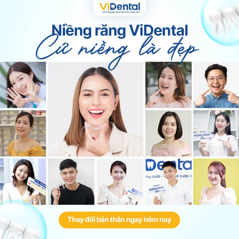 Niềng răng ViDental - Cứ niềng là đẹp