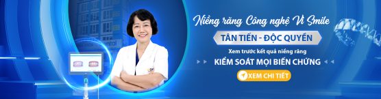 Niềng răng công nghệ niềng răng Vi-Smile